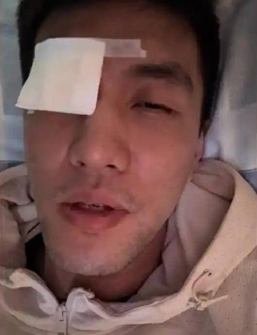 皇冠信用网会员如何申请_郭艾伦病床上接受采访 :医生说不会影响以后视力