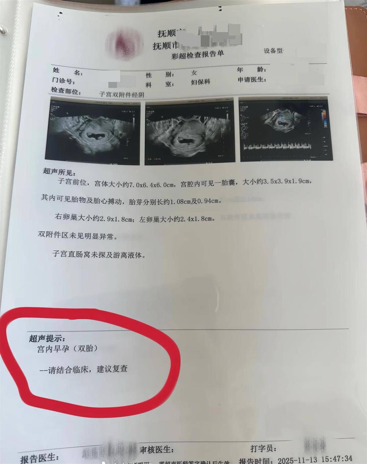 洛斯查兰特vs域堡
_辽宁一孕妇两个月内从一胎变四胞胎洛斯查兰特vs域堡
,每次产检发现多出一胎,医生:系同卵四胞胎,概率1300万至1500万分之一